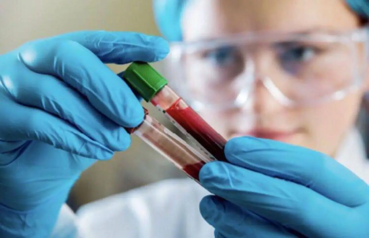 Le malattie del sangue più pericolose: ecco i sintomi gravi a cui prestare attenzione subito